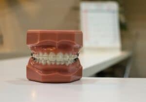 Affordable Braces for Adults in Allentown, PA
