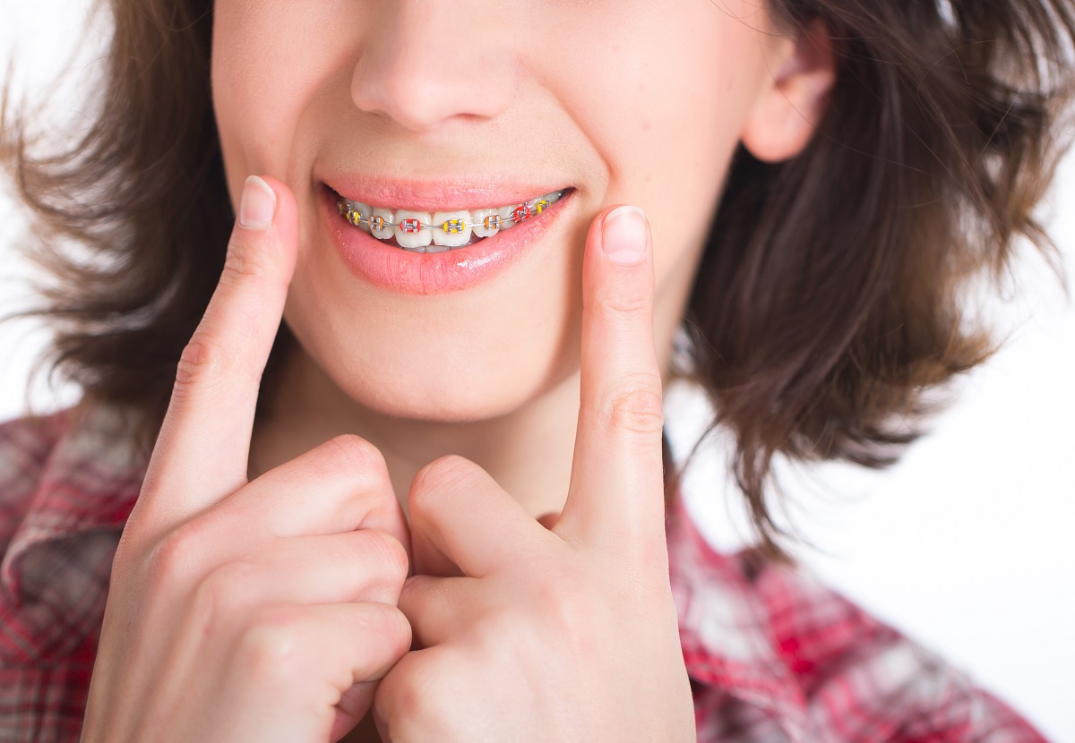 Affordable Braces In Allentown Pa Drbob Bryan 