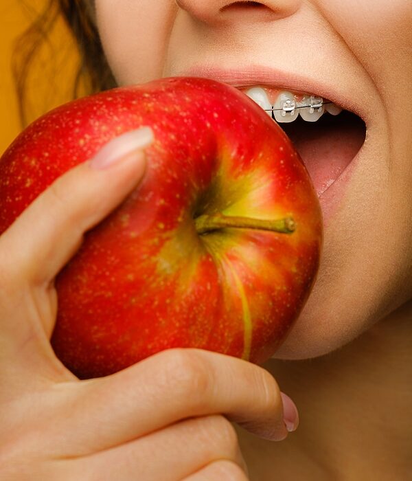 Braces Friendly Foods Dr.Bob Bryan