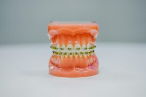 Orthodontist Allentown Advice: Proven Tips to Choose Braces or Invisalign