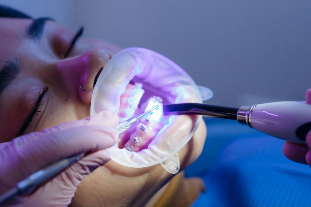 Orthodontist Allentown Advice: Proven Tips to Choose Braces or Invisalign