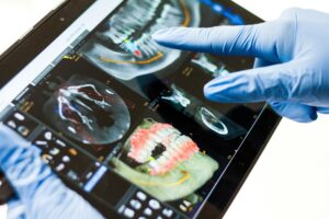 Jaw Surgery in Hamburg PA: Proven Health Benefits Beyond Appearance