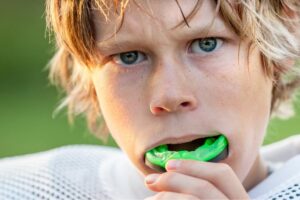 Dental injury prevention with orthodontic mouthguards