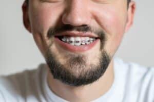 Double Jaw Surgery Recovery Timeline and Checklist