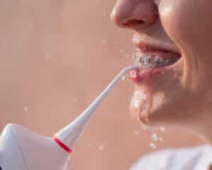 Braces in Allentown