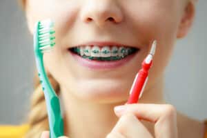 Braces Maintenance Tips for a Healthy Smile
