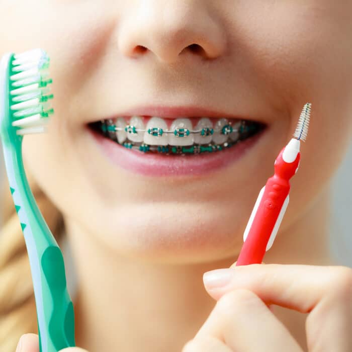 Braces Maintenance Tips for a Healthy Smile