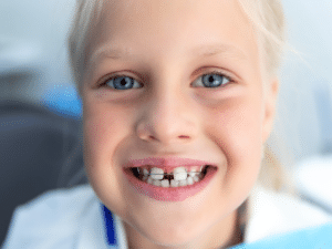 Child smiling with braces showing an early braces gap after treatment