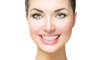 Smiling woman with straight teeth showing the importance of wearing retainers after braces